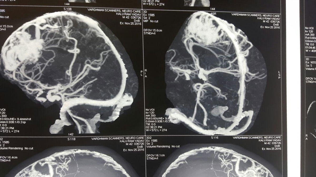 Neuro Care Hospital gallery image 19