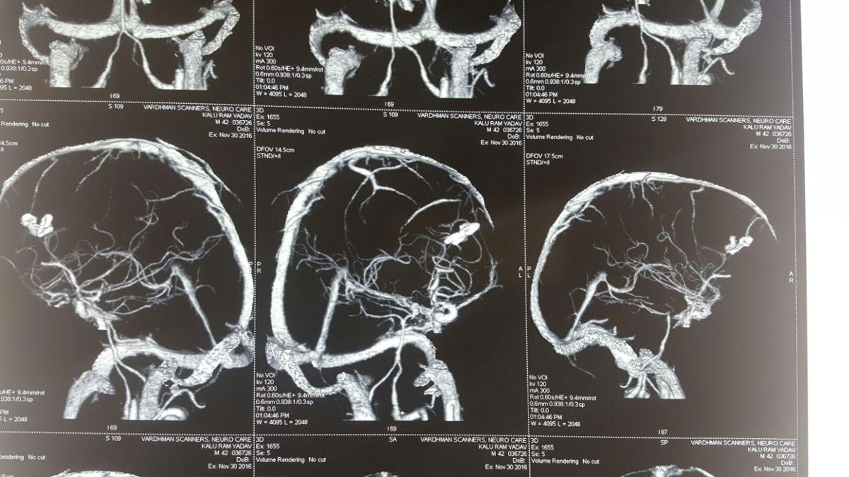 Neuro Care Hospital gallery image 20
