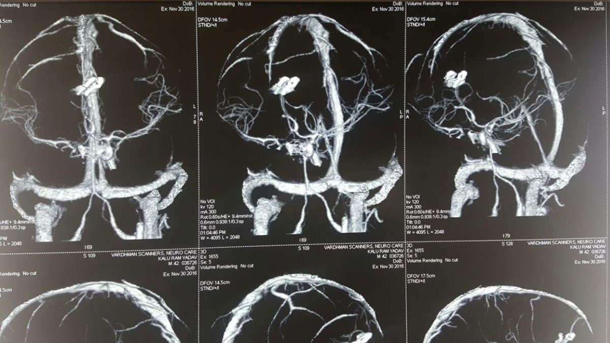 Neuro Care Hospital gallery image 21