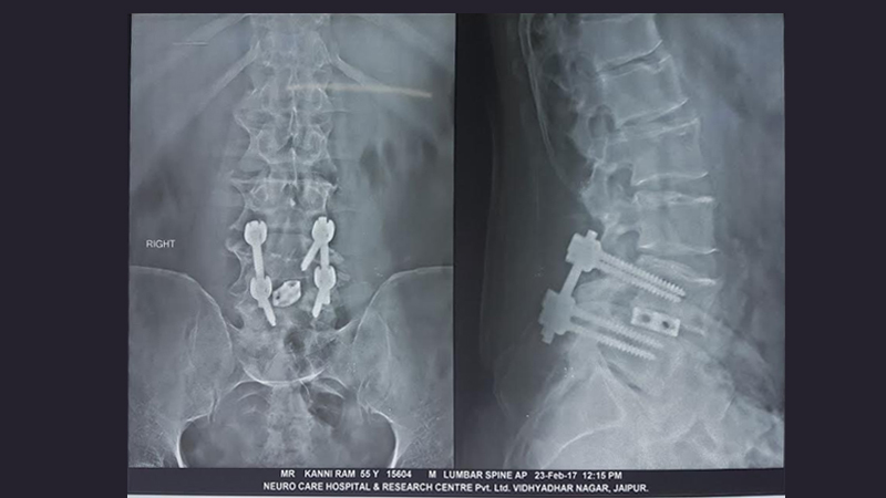 Neuro Care Hospital gallery image 22