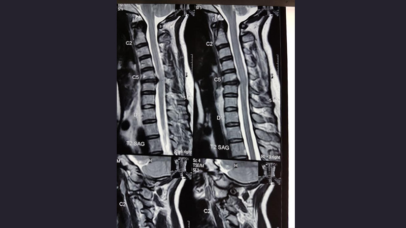 Neuro Care Hospital gallery image 23