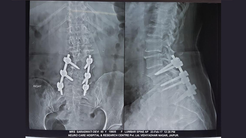 Neuro Care Hospital gallery image 25