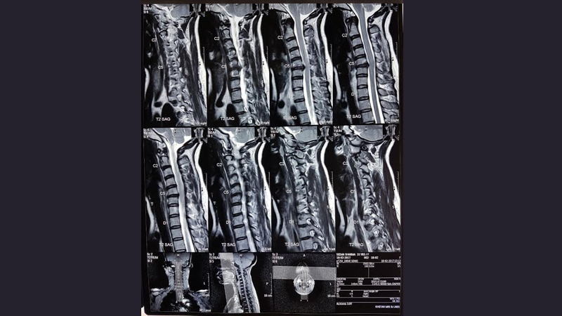 Neuro Care Hospital gallery image 26