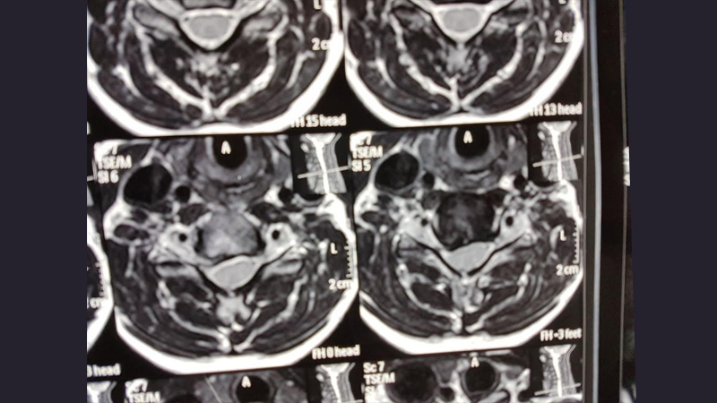 Neuro Care Hospital gallery image 27