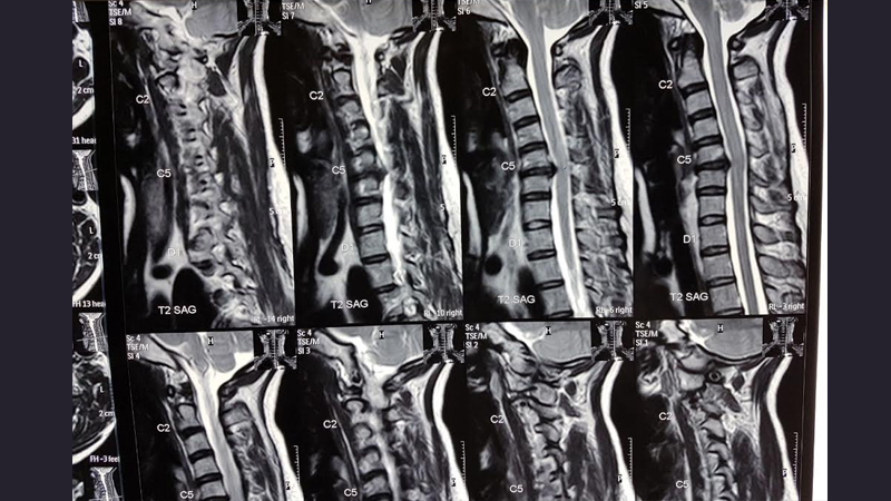 Neuro Care Hospital gallery image 28