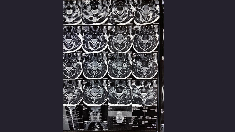 Neuro Care Hospital gallery image 29