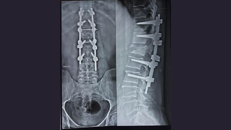 Neuro Care Hospital gallery image 30