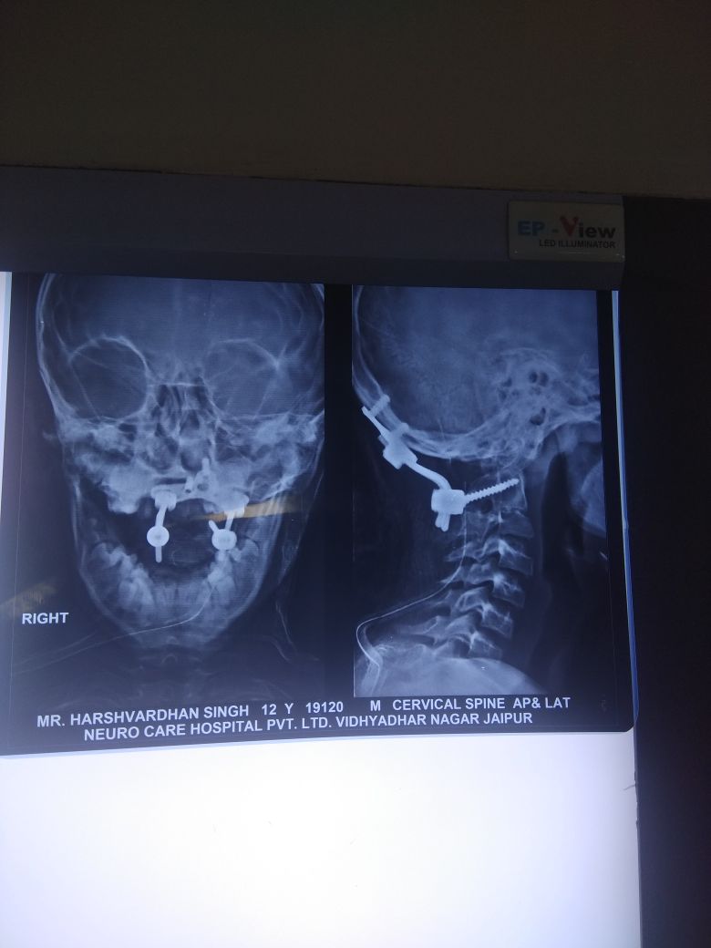 Neuro Care Hospital gallery image 3