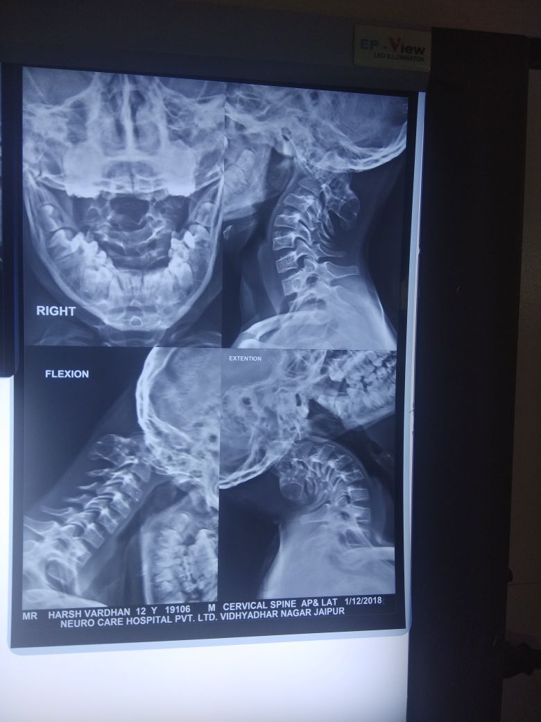 Neuro Care Hospital gallery image 4