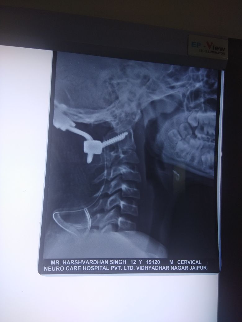 Neuro Care Hospital gallery image 5